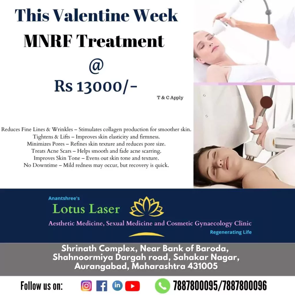 Valentine Offer _13