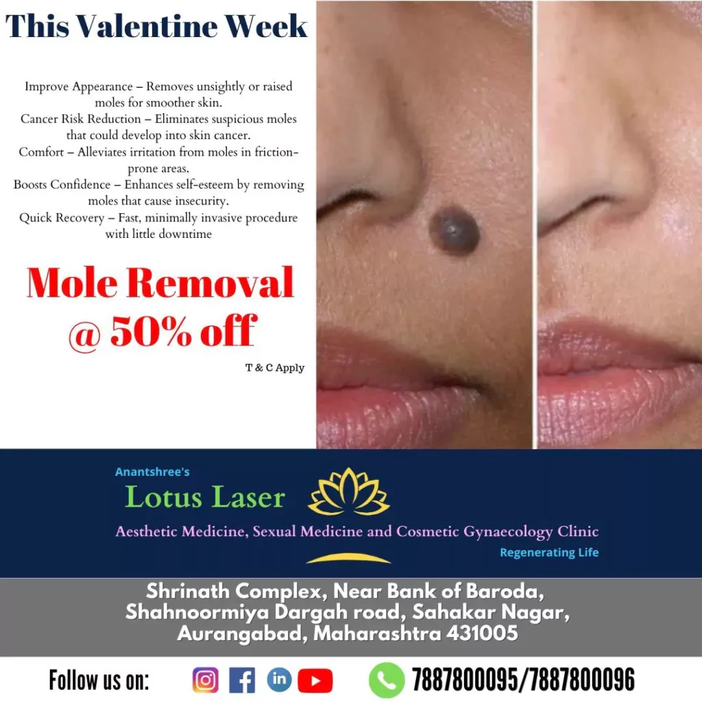Valentine Offer _3