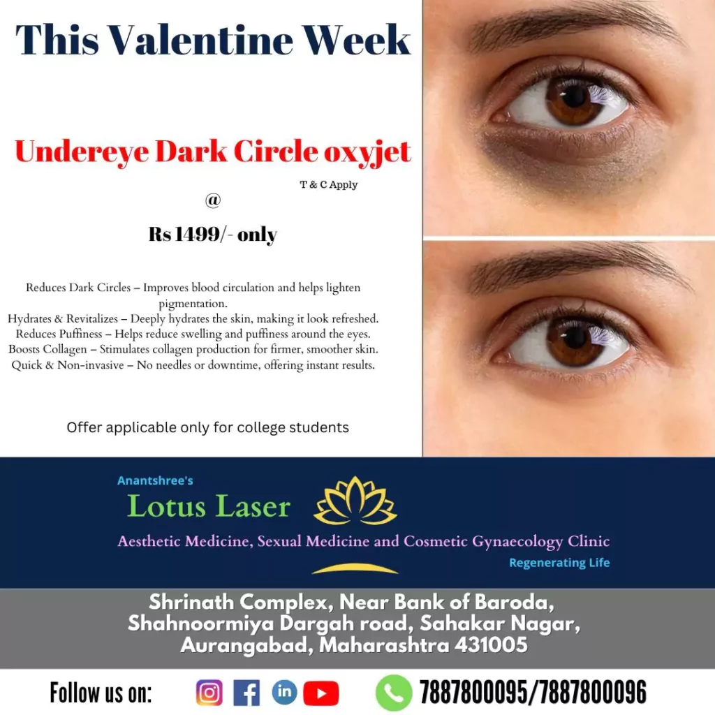 Valentine Offer _4